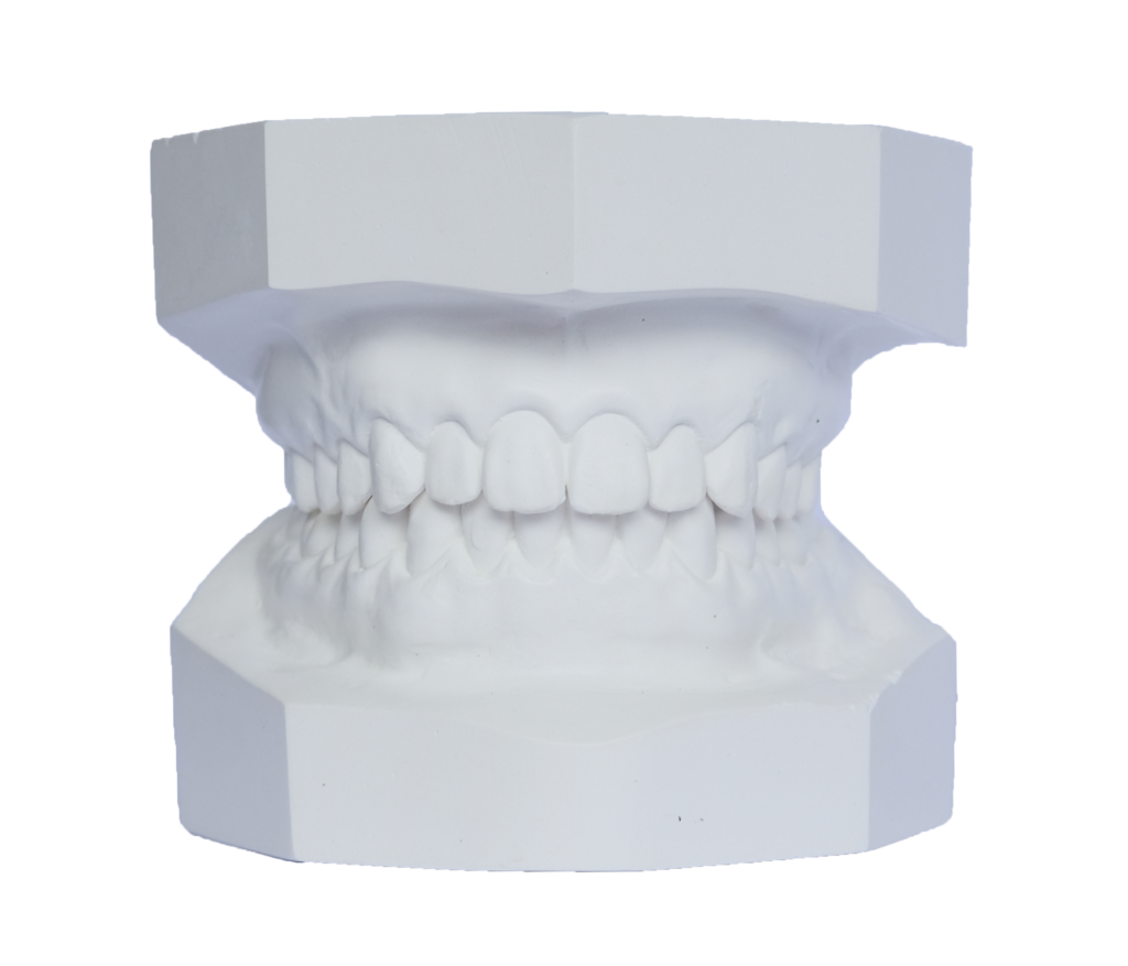 Study Models Dentic Denture Clinic